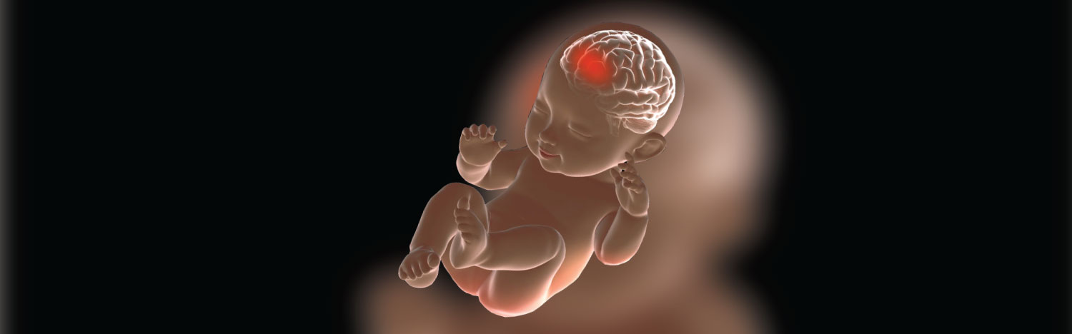 Hoboken: $7.1 M Settlement For Infant Brain Injury