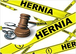 Ethicon Faces Defective Design Lawsuit For Its Hernia Mesh 