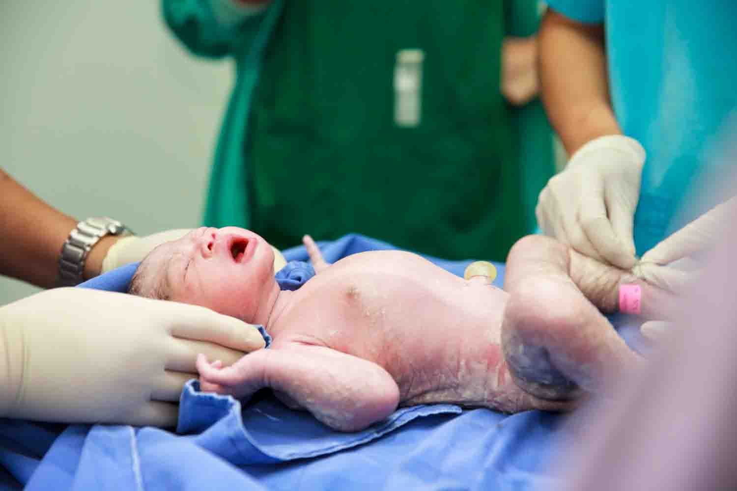 Birth Injury Status in the U.S. in a Nutshell
