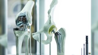 Zimmer Kinectiv Hip Replacement Case Filed Over Metallosis